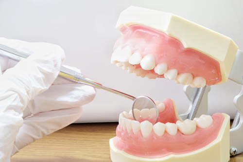 月島稲葉歯科の虫歯治療